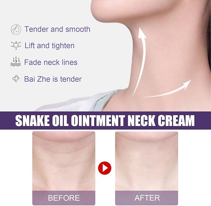 Neck Creams for Tightening and Wrinkles,Neck Firming Cream,Anti Wrinkle & Lifting Neck Lines,Nourishing Neck Tightening Cream,Sagging Neck Cream,Neck and Chest Firming Cream,Double Chin-Easy to Use - British D'sire